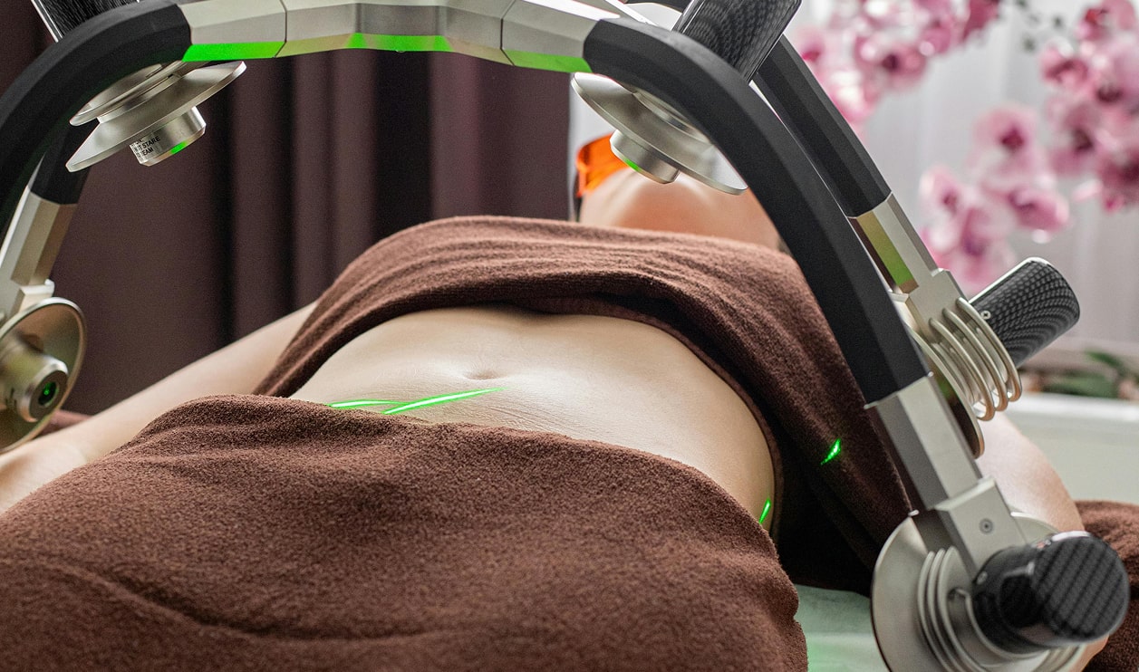 Tummy Tuck